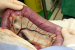 Large intestine blood supply