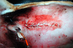 Tight skin sutures