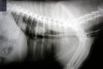 X-ray bone in oesophagus